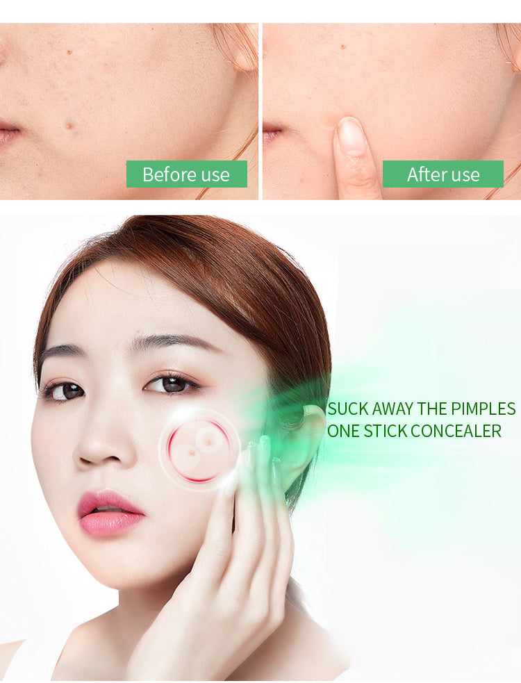 Patch d'acné personnalisé, maquillage imperméable, invisible et facile à appliquer, fabricant source, patch d'acné, traitement OEM