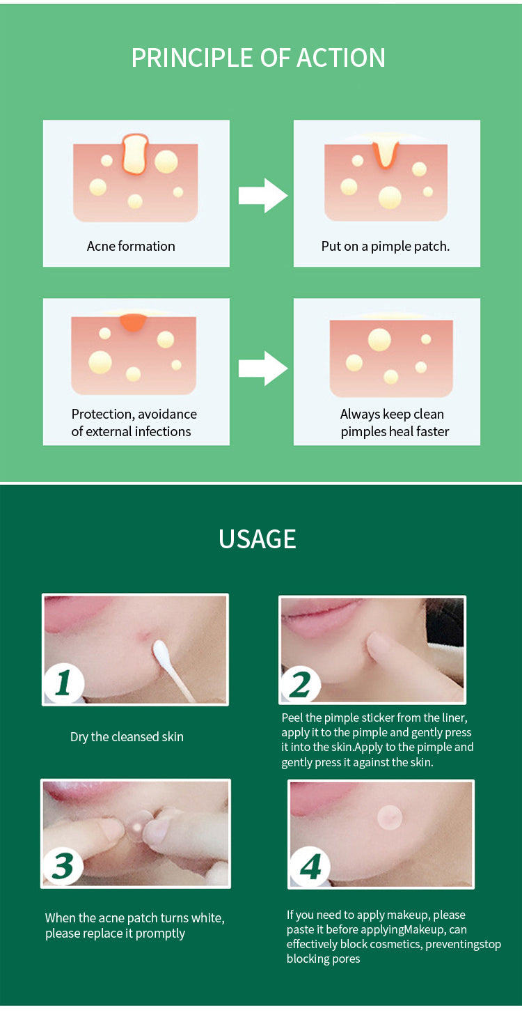 Aangepaste acne-patch, waterdicht, onzichtbaar en gemakkelijk aan te brengen make-up, bronfabrikant, acne-patch, OEM-verwerking