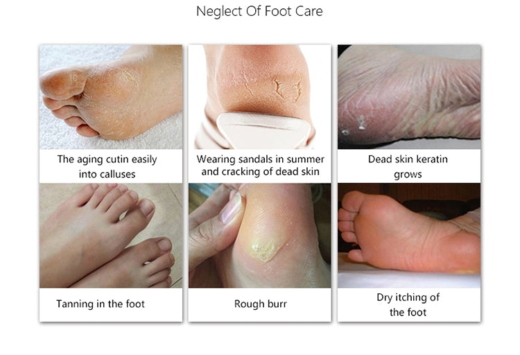 Masque de pied soins des pieds soins de la peau usine cosmétiques traitement personnalisé OEM